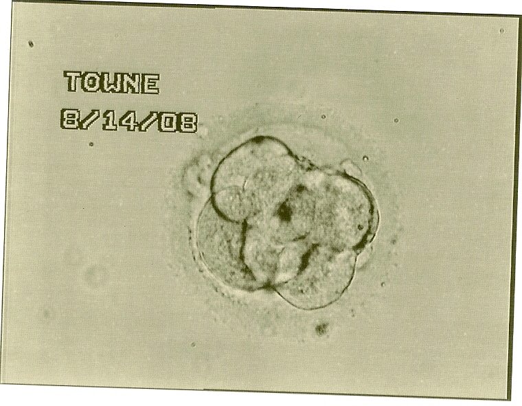 IVF embryo