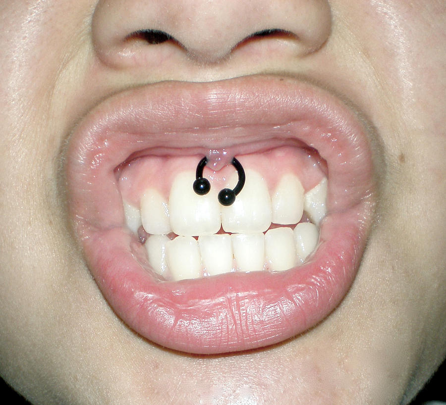 small smiley piercing. small smiley piercing. the