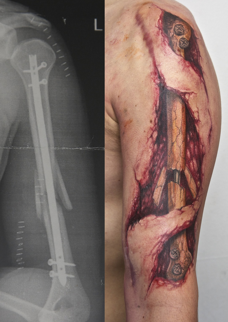      broken_arm_tattoo_by